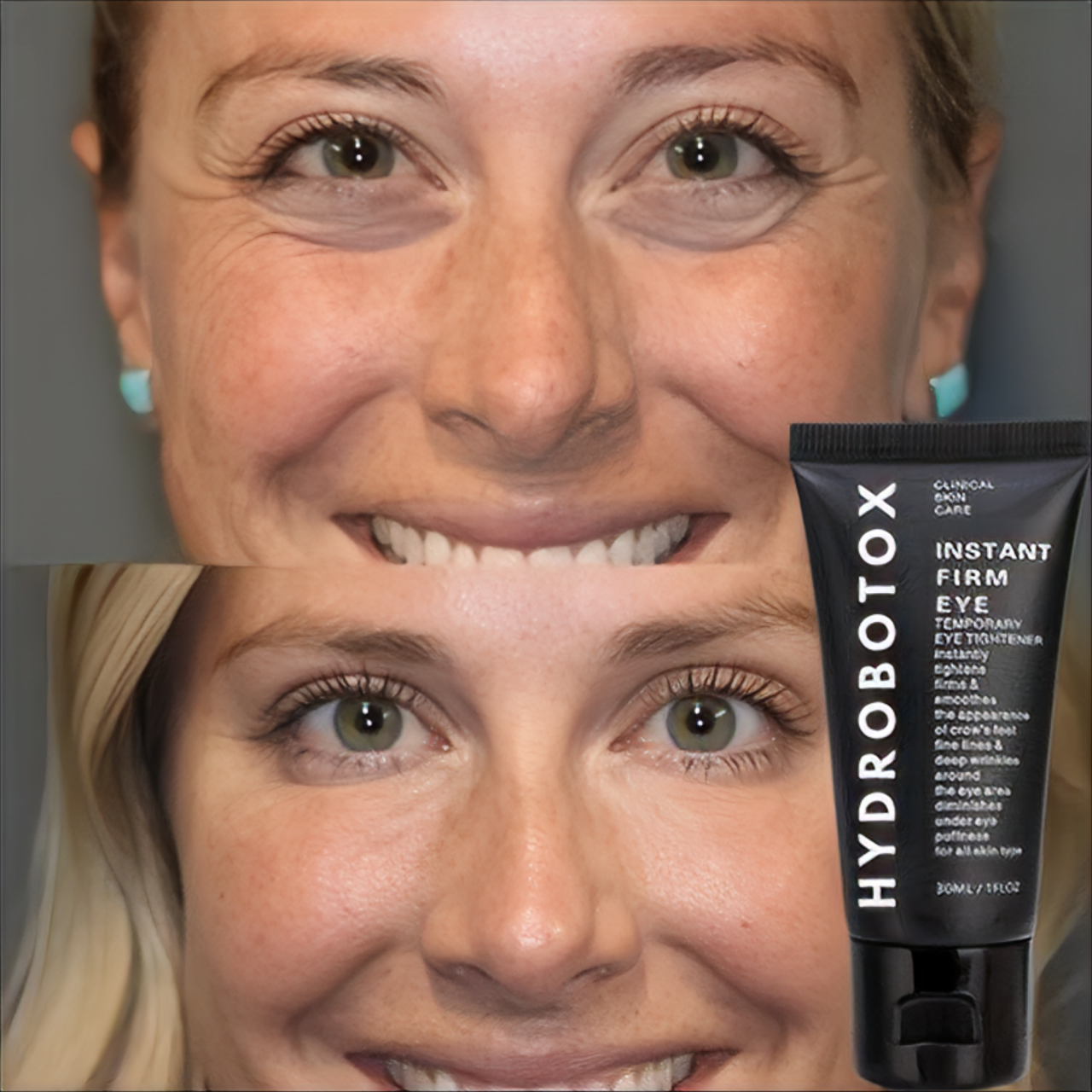 HydroBotox: Creme Lifting Express