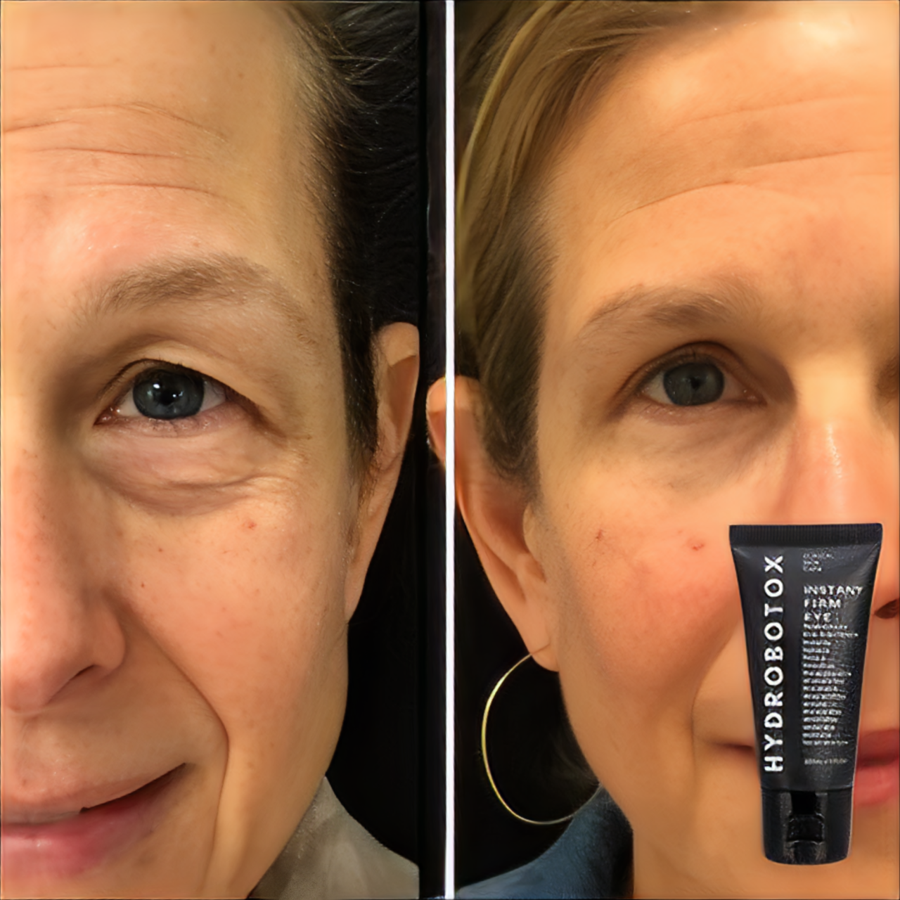 HydroBotox: Creme Lifting Express