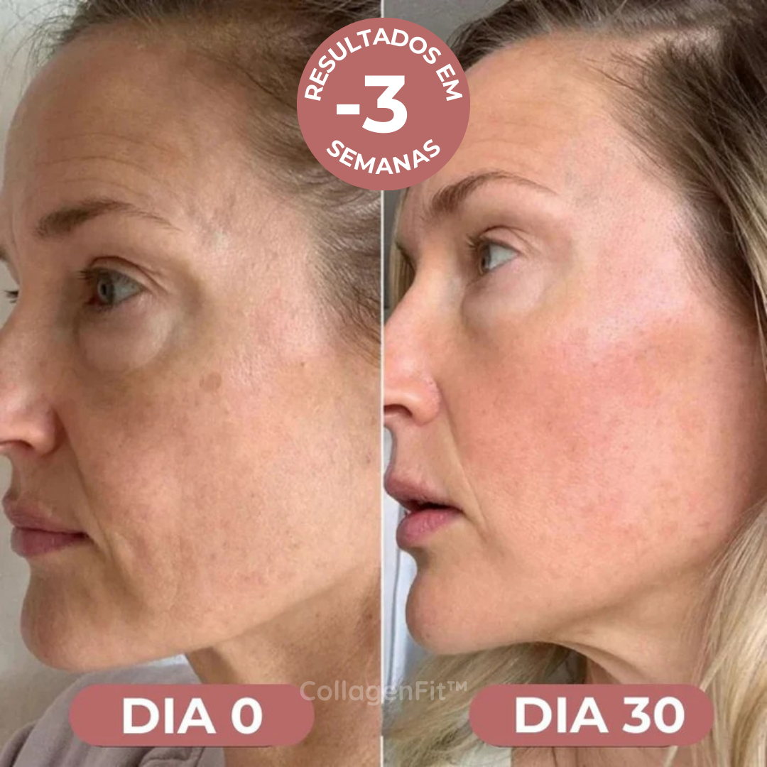 CollagenFit | Máscara de Colagénio Reafirmante e Hidratante