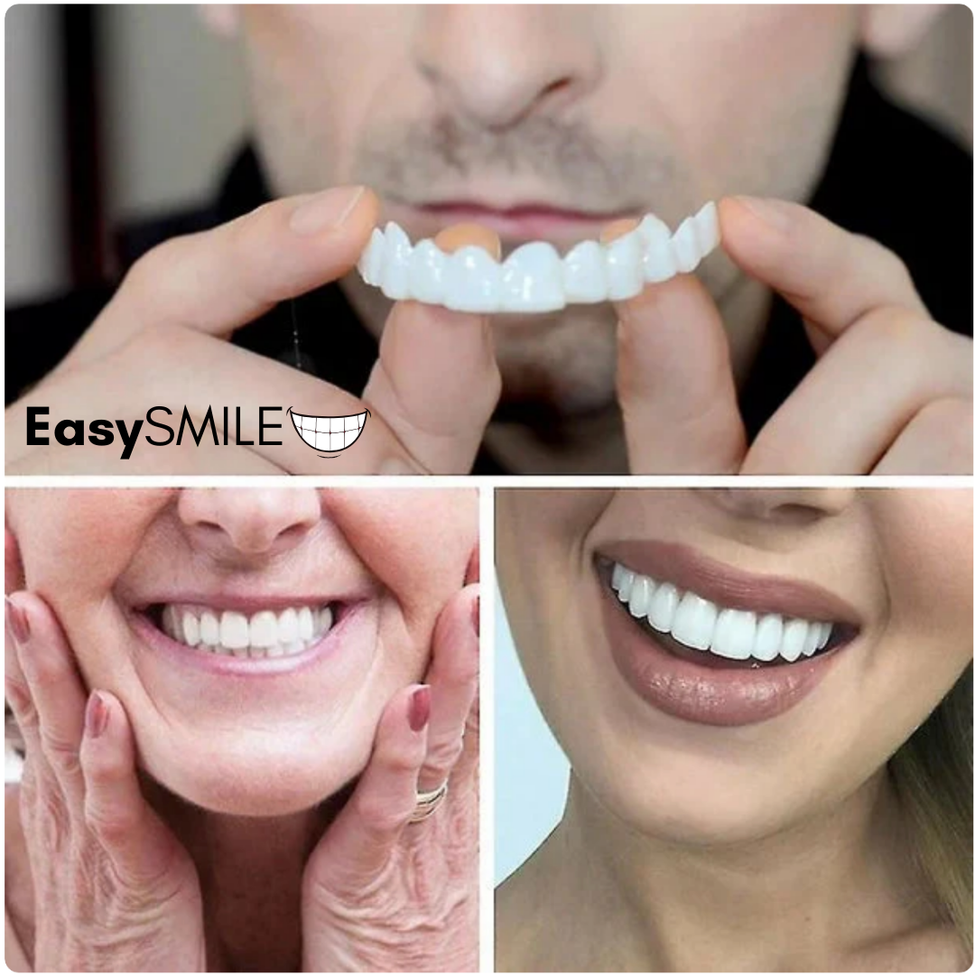 EasySmile | Facetas dentárias de cerâmica adaptáveis