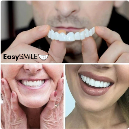 EasySmile | Facetas dentárias de cerâmica adaptáveis