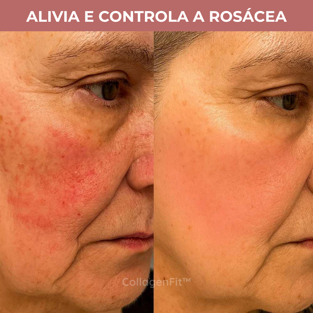 CollagenFit | Máscara de Colagénio Reafirmante e Hidratante